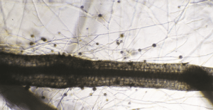 Root with Mycorrhizae
