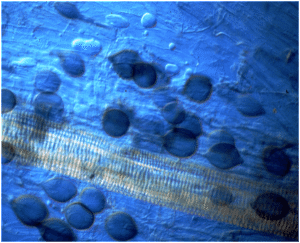 Figure 1 (top). Magnification detail of root cell containing an arbuscule (little tree) endomycorrhizal structure. Figure 2 (bottom). Magnification of vesicles (round balloon-like structures) found between plant root cells.