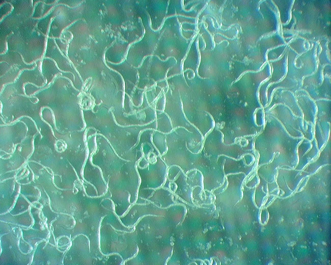 Entomopathogenic nematodes (Steinernema feltiae).
